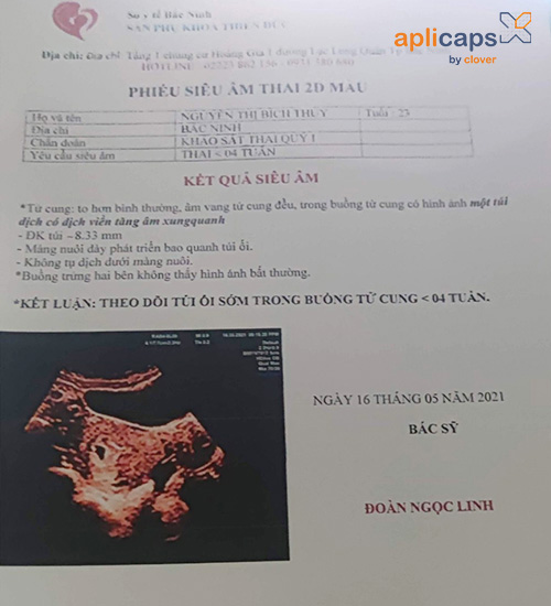 Giấy siêu âm thai 4 tuần