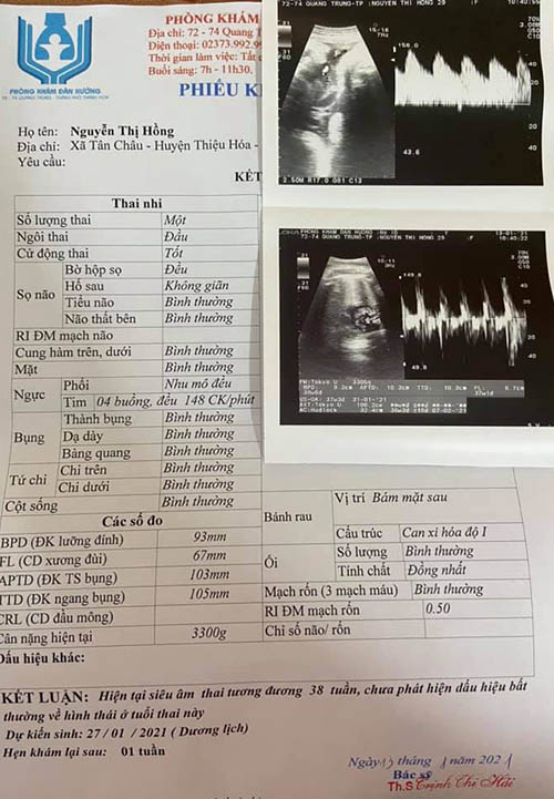 Giấy siêu âm 36 tuần