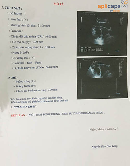 Giấy siêu âm 8 tuần
