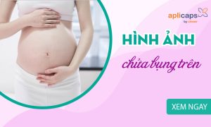 hinh-anh-chua-bung-tren