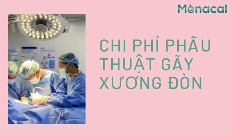 Chi phí phẫu thuật gãy xương đòn