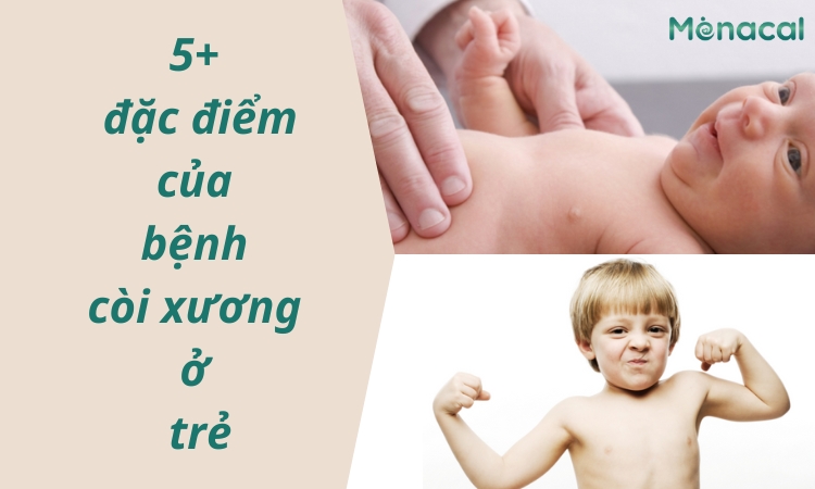 đặc điểm của bệnh còi xương