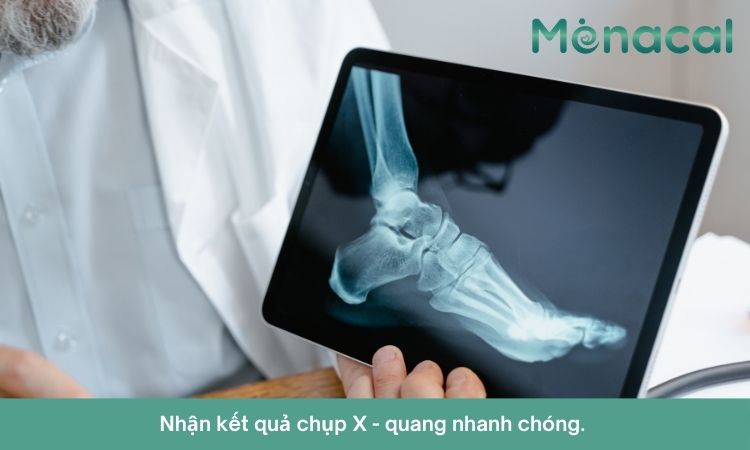 Kết quả chụp X quang bàn chân được trả về trong thời gian ngắn