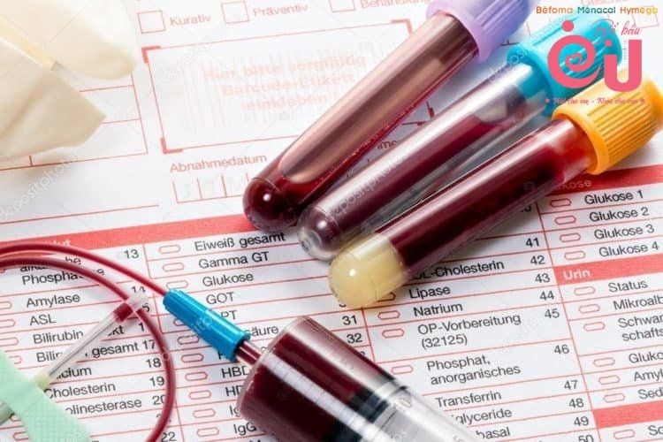 Cần làm các xét nghiệm cần thiết để đánh giá tình trạng