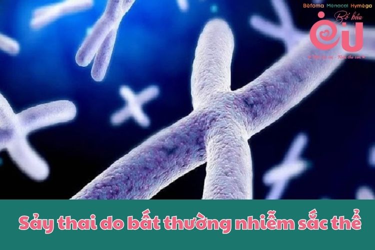 50% sảy thai không phải do mẹ mà do sự bất thường nhiễm sắc thể