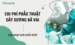 chi-phi-phau-thuat-gay-xuong-ba-vai