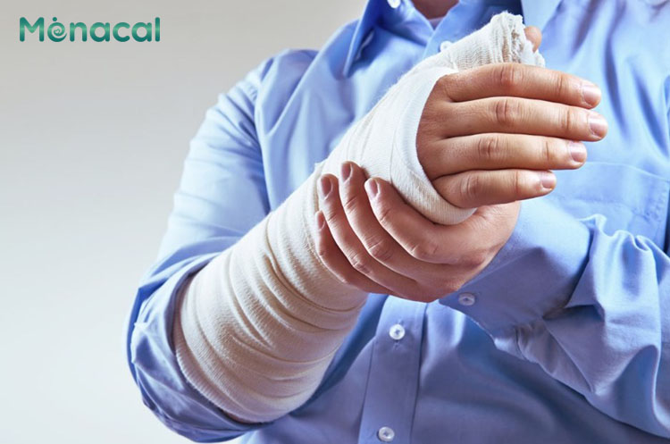 Mức độ nghiêm trọng của vết gãy xương tay cũng ảnh hưởng tới chi phí phẫu thuật