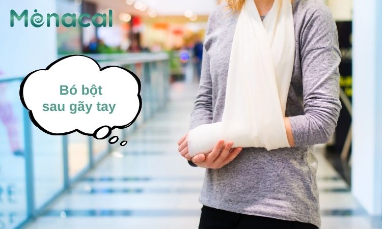 Bó bột sau gãy tay thường mất nhiều thời gian hồi phục. 