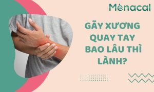Canxi EU Aplicaps Menacal hỗ trợ phục hồi gãy xương quay tay