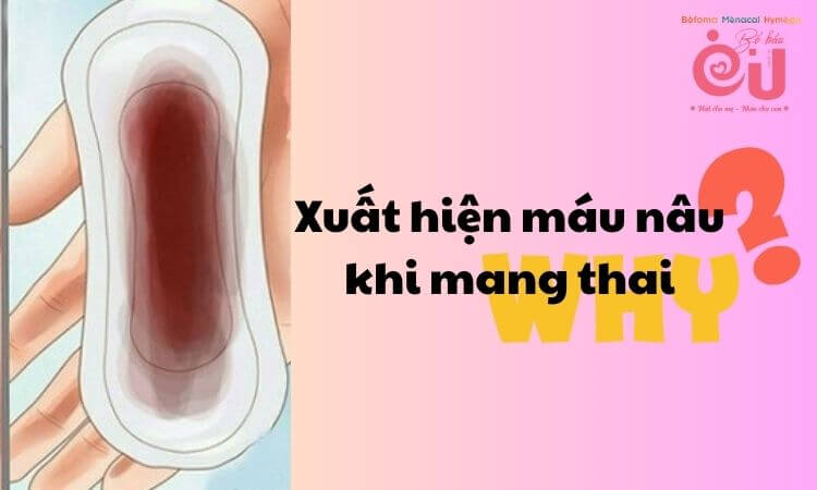 Nguyên nhân xuất hiện máu nâu khi đang mang thai