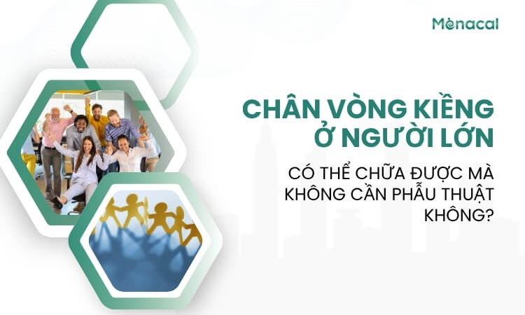chân vòng kiềng ở người lớn có thể chữa được mà không cần phẫu thuật không