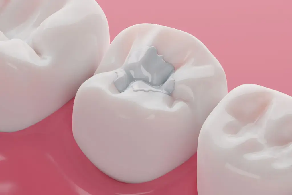 Child receiving kids dentistry treatment in Los Angeles