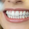 Cosmetic Dentistry Solutions for Long-Lasting Smile Results