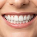 Permanent Dental Implants for a Natural-Looking Smile