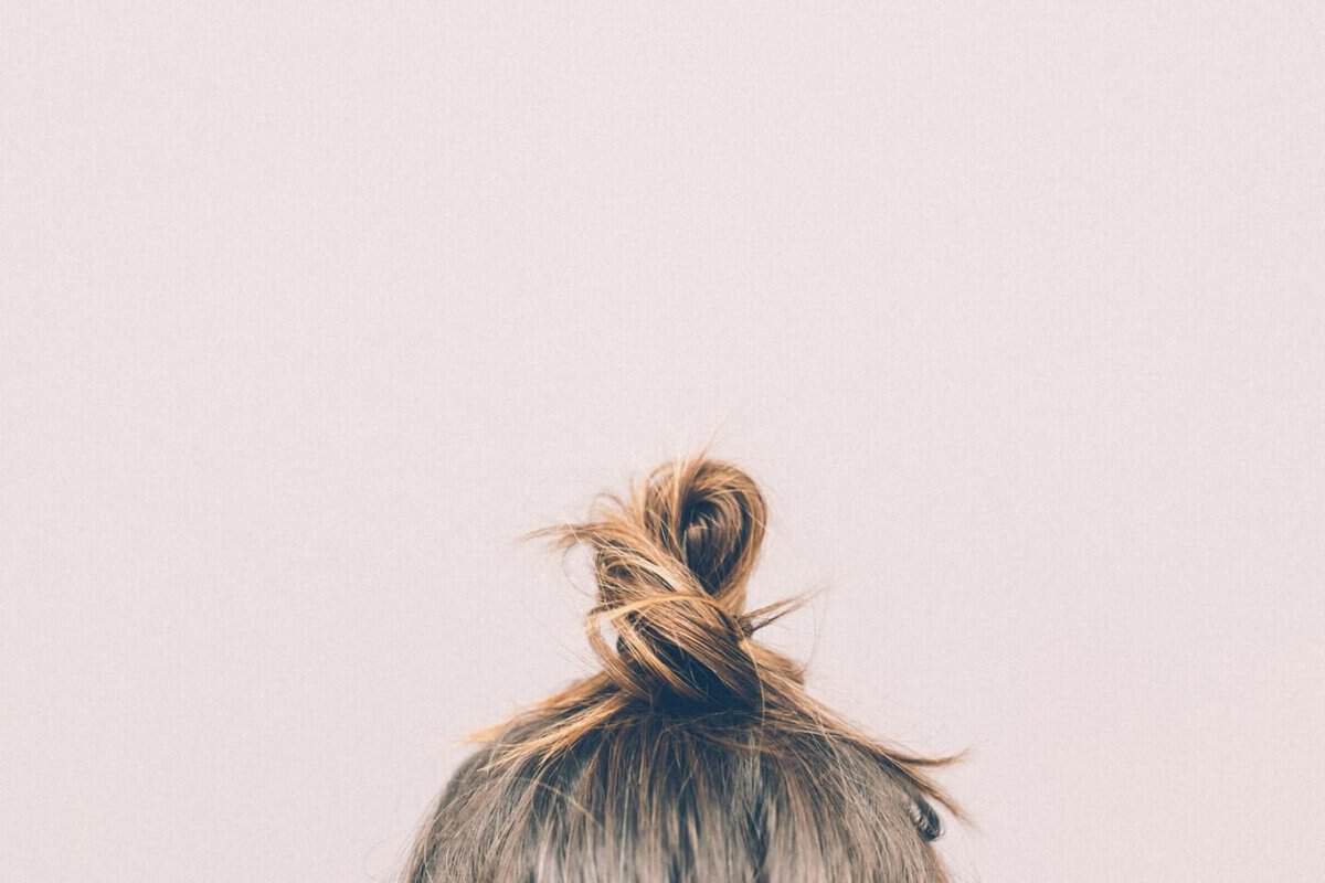 Wearing a hair topper with seborrheic dermatitis