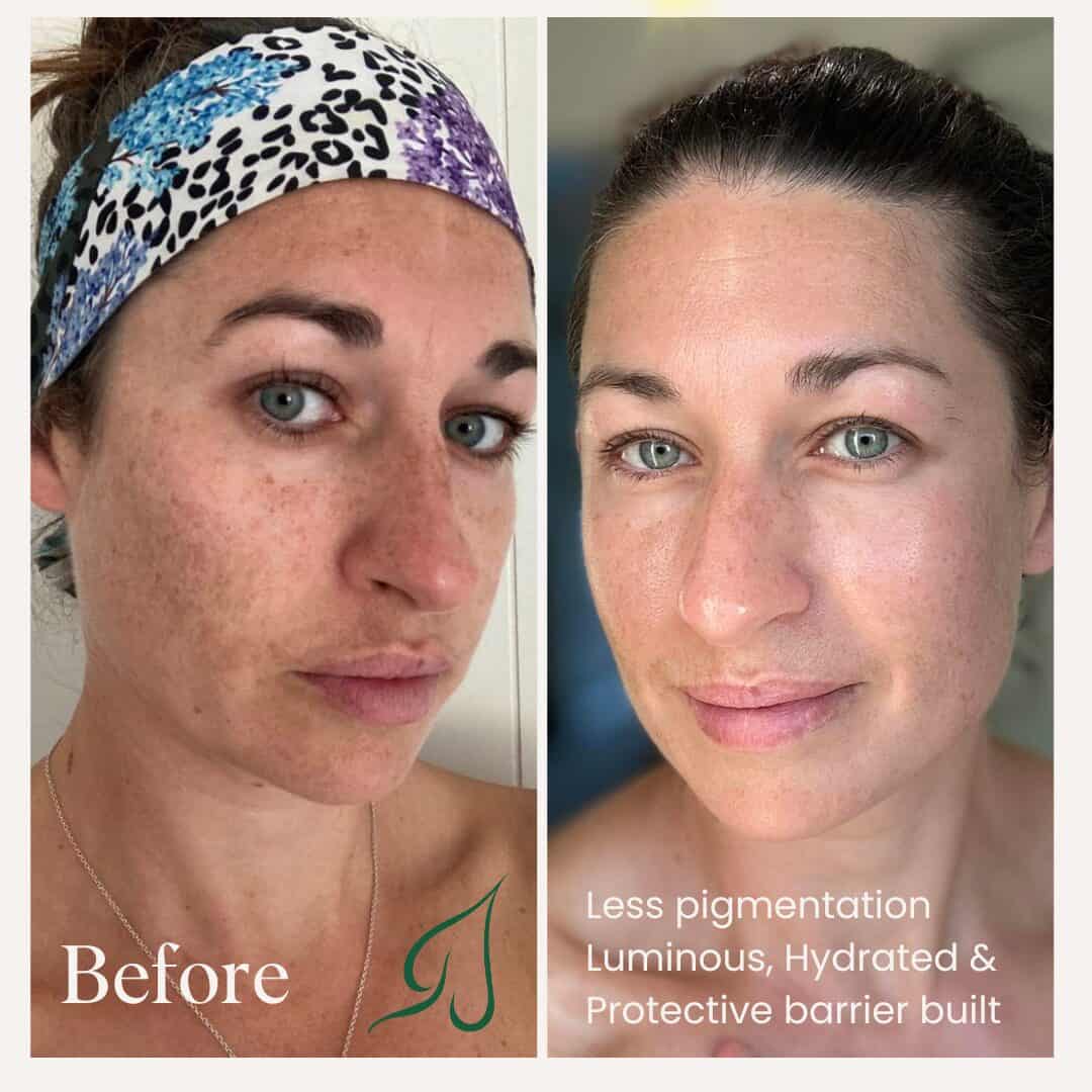 BeforeAfter1
