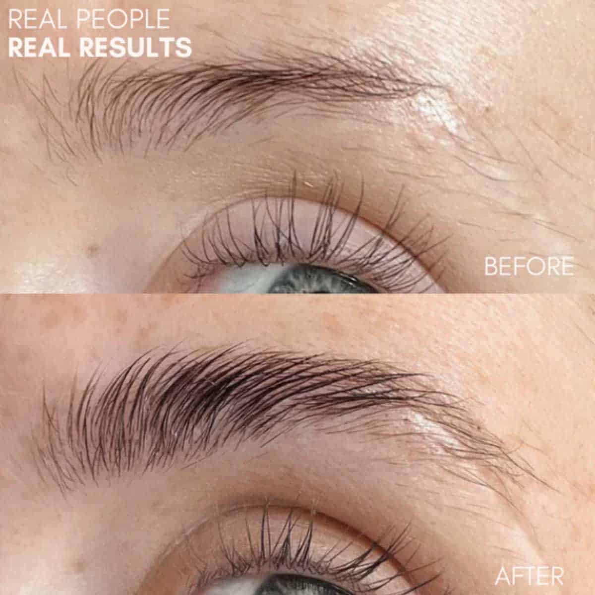 Glow For It<br/> Brow Growth Serum™ - Image 3