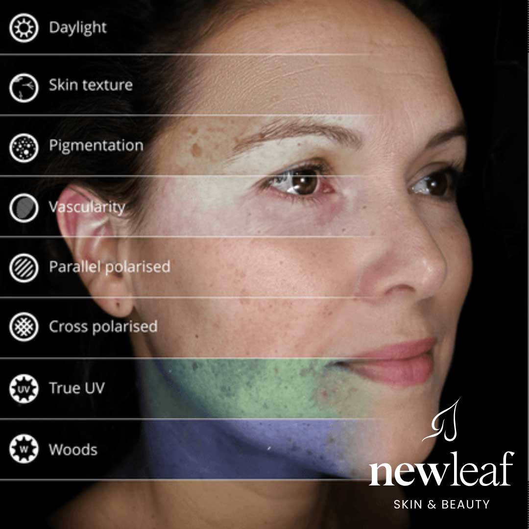 Ultraceuticals Observ Skin Analysis Event - Image 2