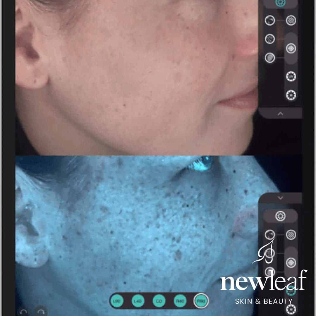 Ultraceuticals Observ Skin Analysis Event - Image 3