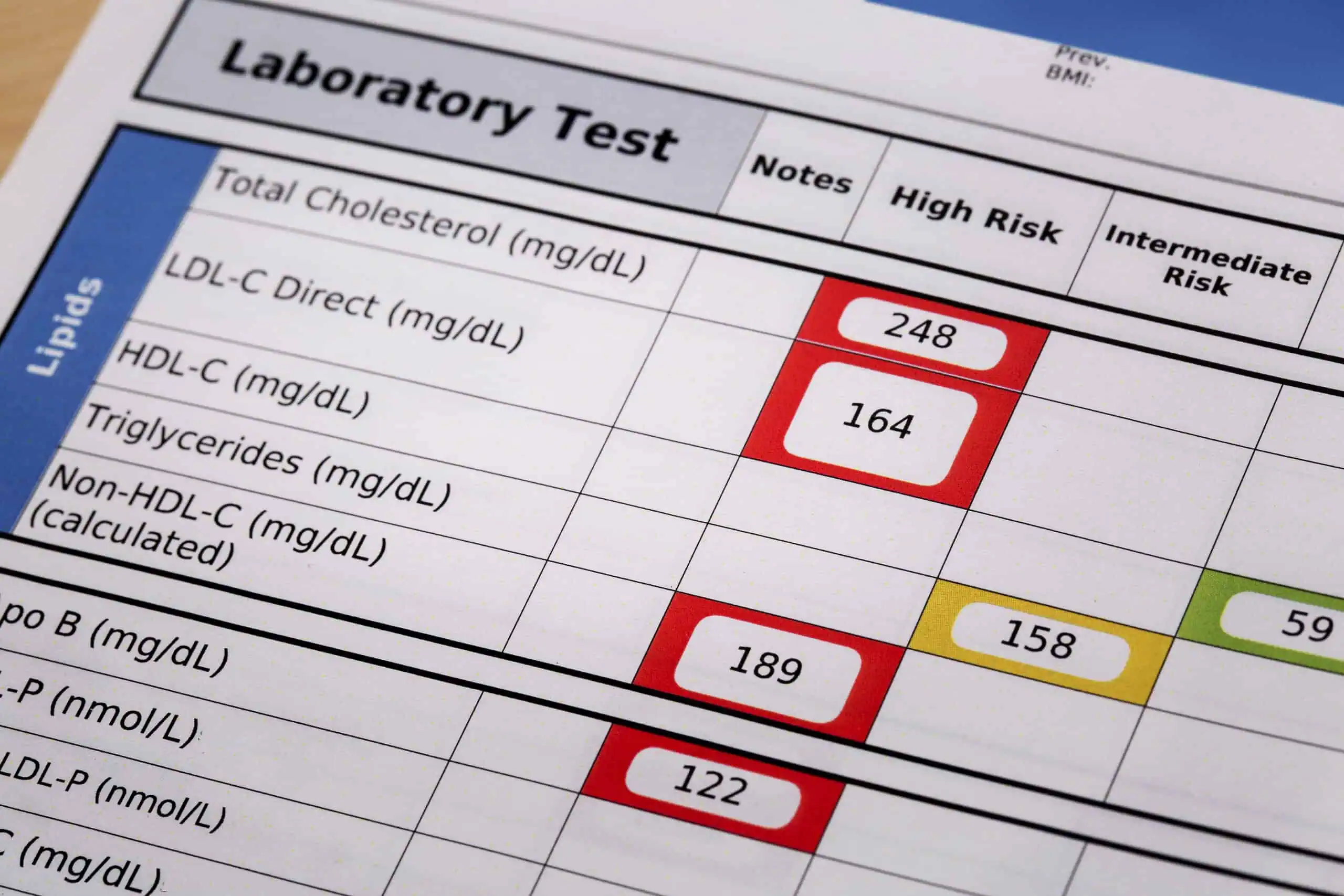 Close-up of a laboratory test report showing lipid panel results, with total cholesterol, LDL, and triglyceride values highlighted in red for high risk—an important tool for Primary Care in Cayman.