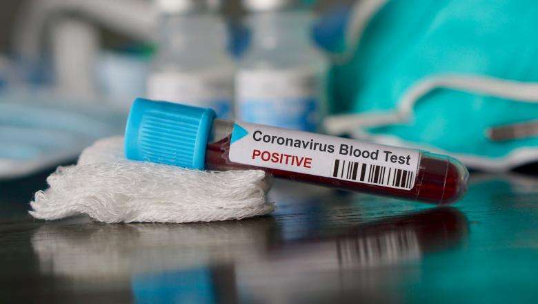Coronavirus Decedat