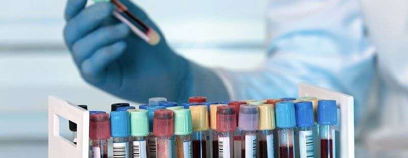 Situația la zi în Sibiu - 12 cazuri noi și 13 persoane reconfirmate