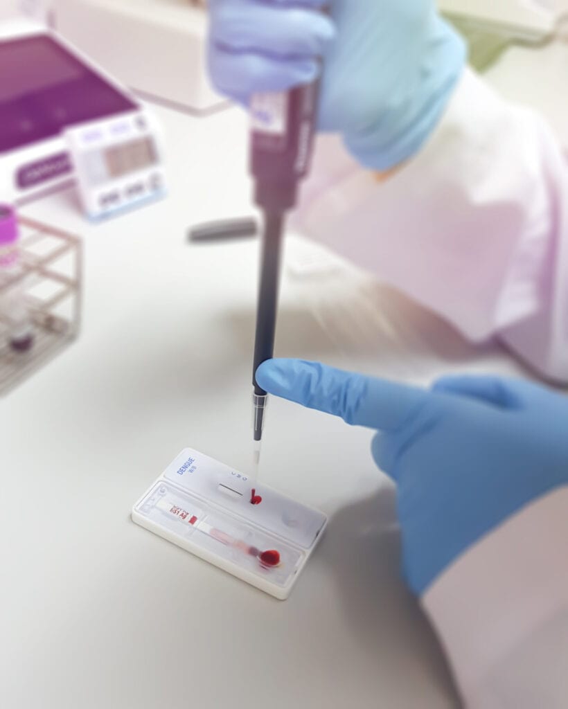Laboratory technician performing blood test with pipette and test kit.