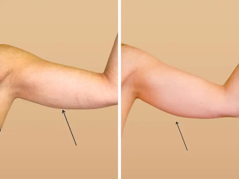 Before & After 1