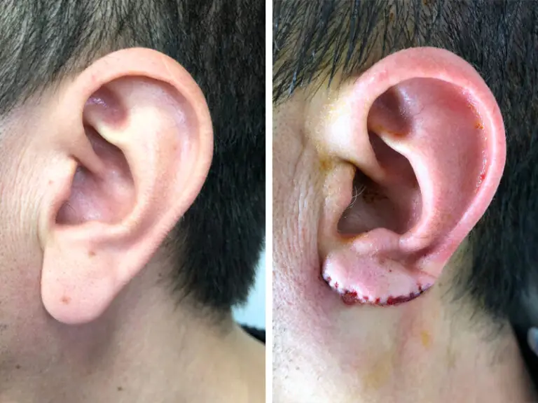 Before & After 3