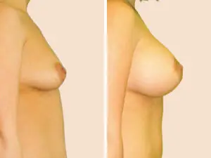 BAN 32 B