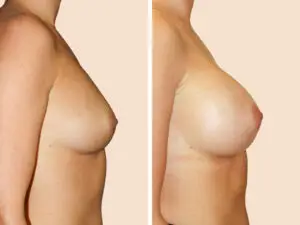 BAN 36 B