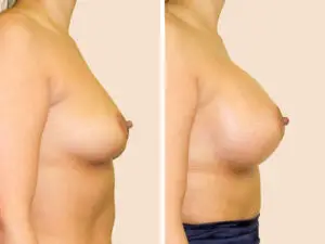BAN 37 B