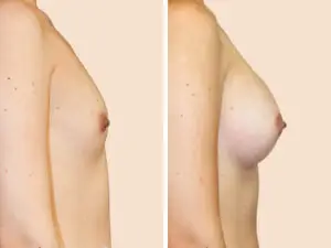 BAN 43 B