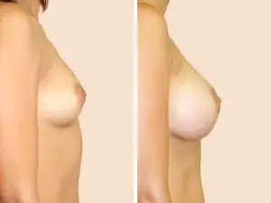 BAN 46 B