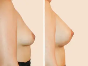 BAN 47 B
