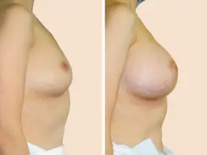 BAN 63 B