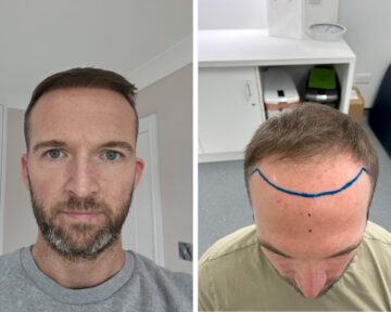 | Private Gp Clinic | West Byfleet | Sunningdale | Reigate | Farnham | Wokingham