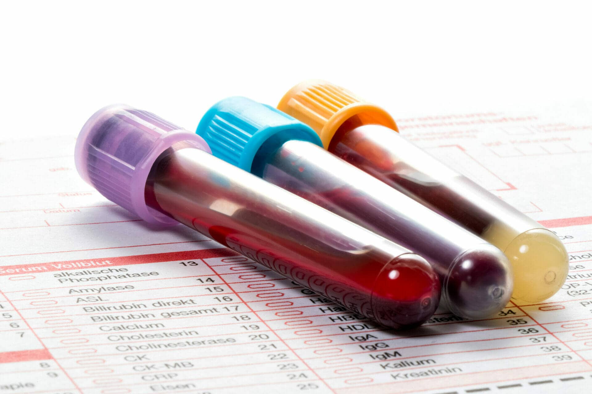 Blood Tests 1.Jpg