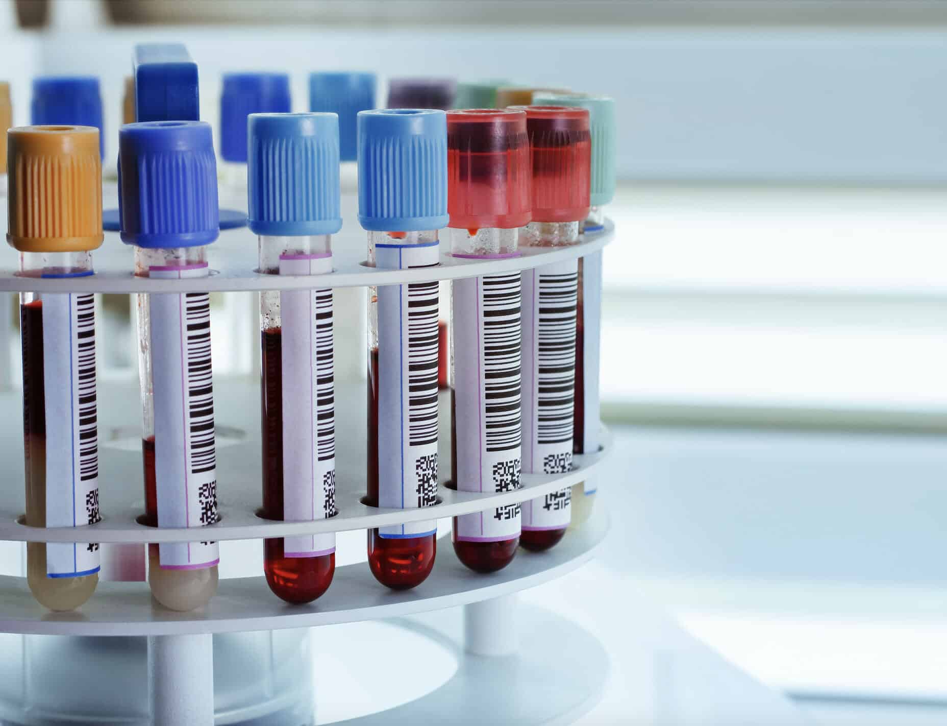 Blood Tests In Farnham