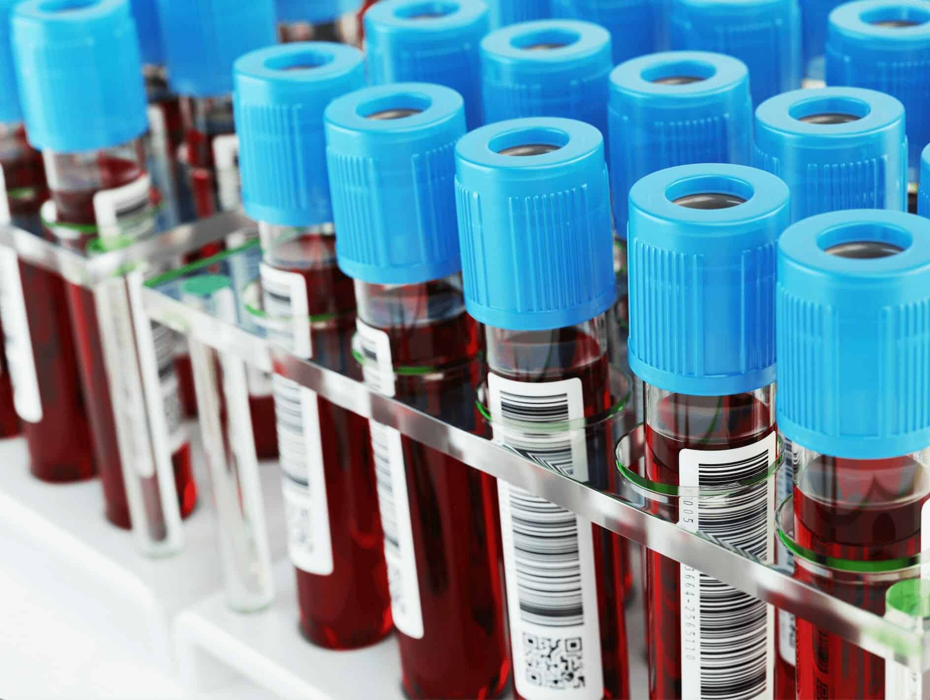 Blood Tests In Sunningdale.jpg