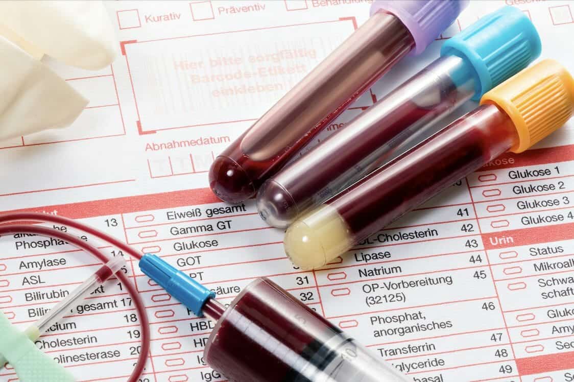 Blood Tests Putney.jpg