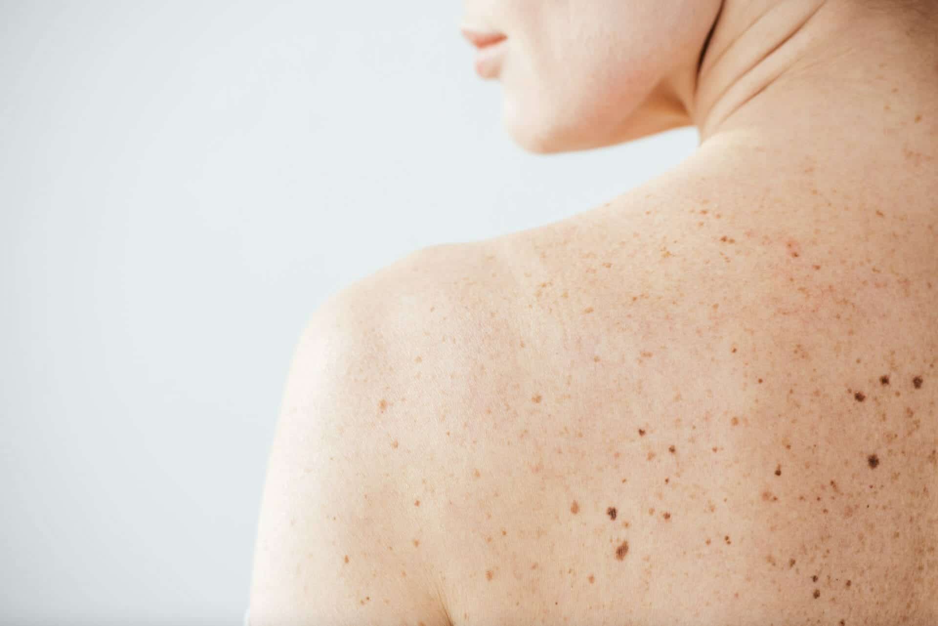 Private Dermatology Clinic In Sunningdale.jpg