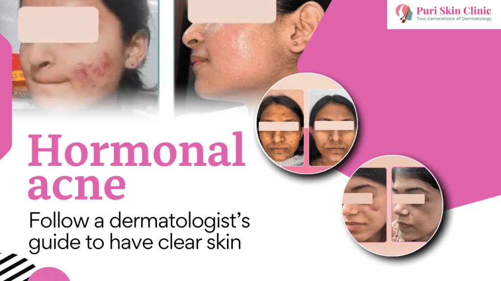 orthoderma yb thumbnail (14)