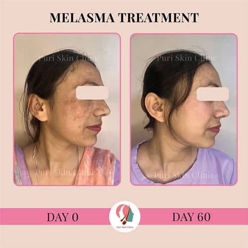 da 0000 hair 3 0002 img 9174