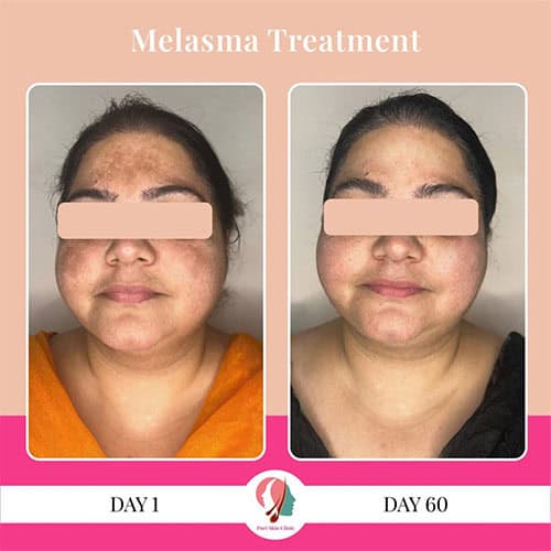 da 0000 hair 3 0003 image 19 1024x1024