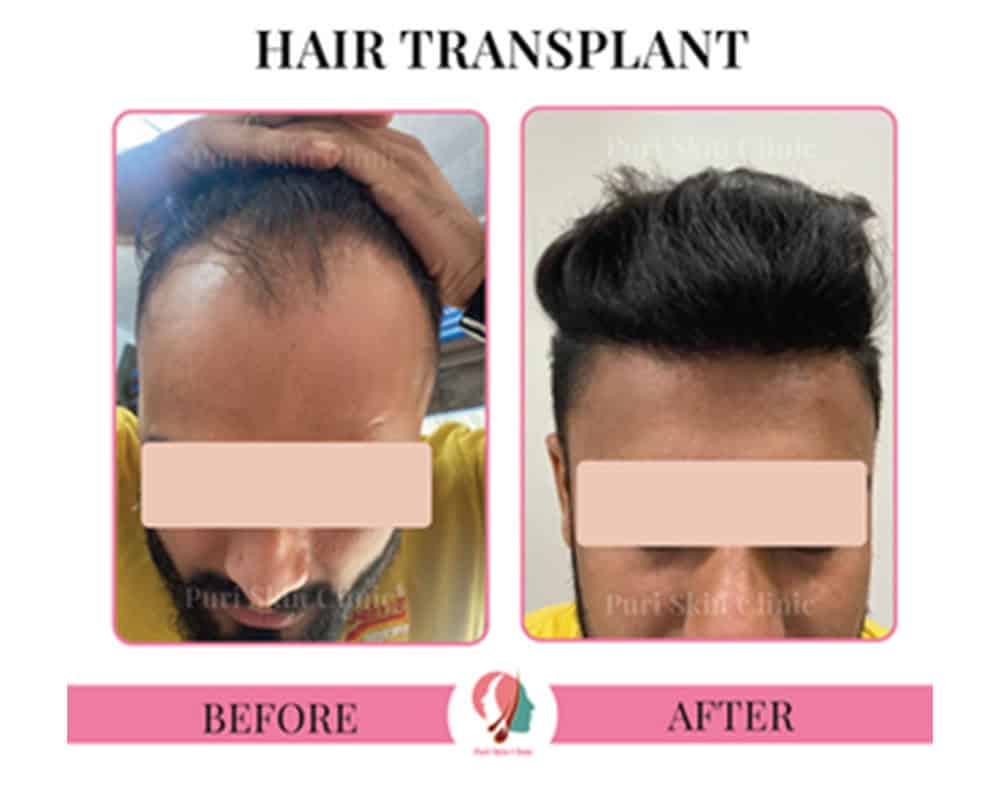 ss 0001 sucess stories image 2