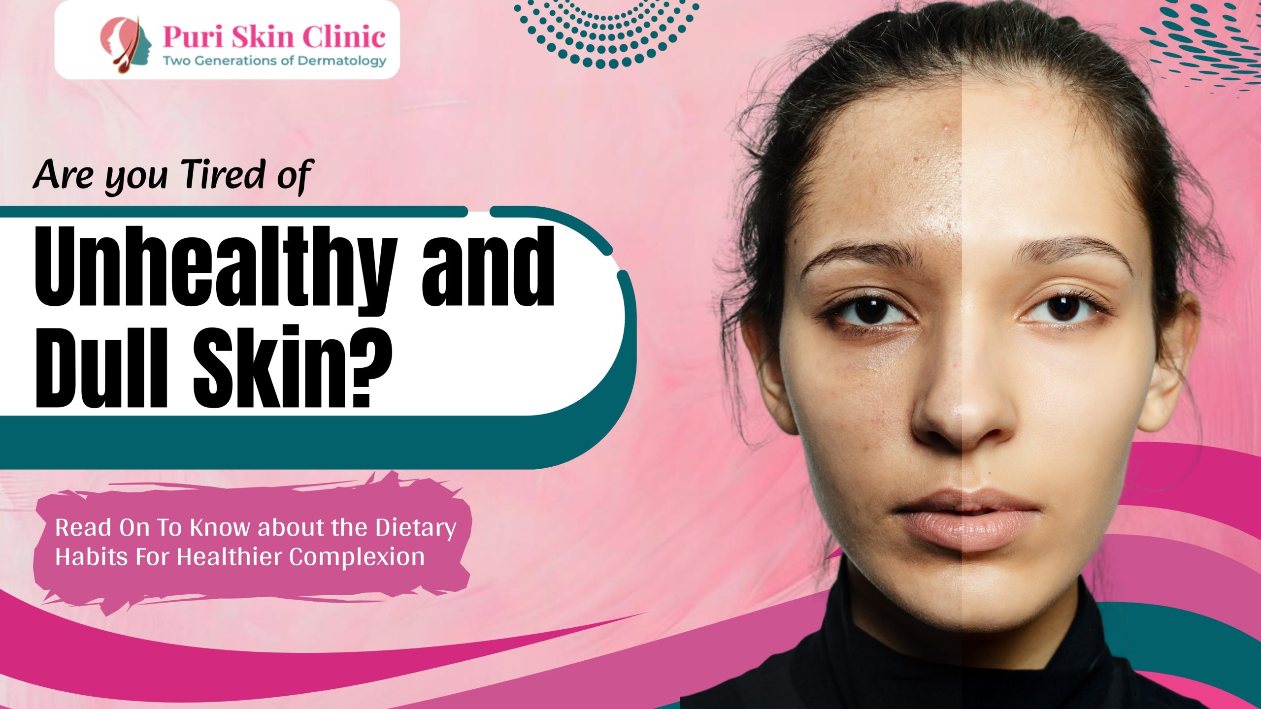 are you tired of unhealthy and dull skin? read on to know about the dietary habits for healthier complexion