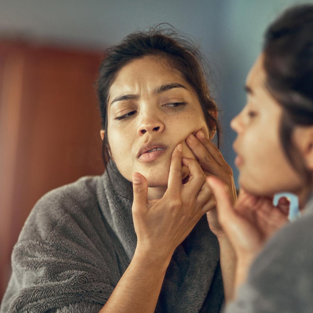 Acne Pigmentation Care