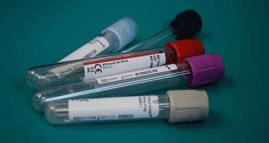 Blood sample test tubes with colored caps on a teal background for wellness screening and diagnostics.