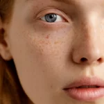 Rutina pentru ten pigmentat - imagine 2